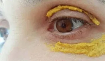 Me sorprendí al ver a mi amiga sin ojeras y un rostro hermoso; le supliqué para que me dijera el secreto. Descúbrelo!!