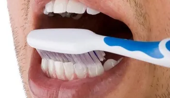 ¿Qué es la hipoplasia o alteración color del diente?