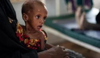 Cantidad de niños raquíticos en África va en aumento, dice informe OMS 