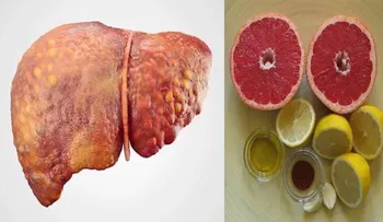 Mezclé estos tres ingredientes y mi hígado quedó totalmente limpio