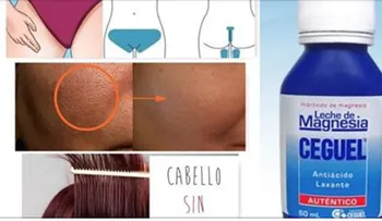 La leche que actúa como una "magia blanca" en la piel: También es ideal si tiene estreñimiento 