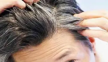 Las canas no aparecen por estrés, la culpa es de tu genética