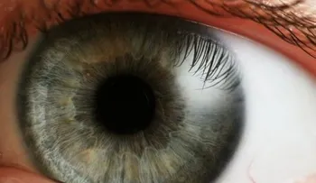 ¿A qué se debe la visión borrosa y cómo tratarla?