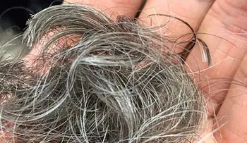 Las canas pueden aparecer por algunas enfermedades; cómo retrasar su aparición