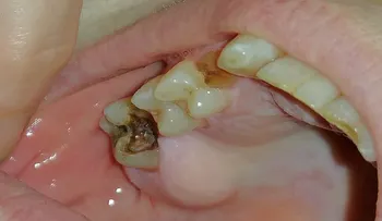 Toma esta medicina y tus dientes empezaran a repararse por sí mismos y siempre estarán sanos y libres de sarro y caries! ¡sensacional!