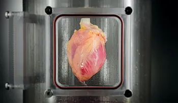 Cómo será el corazón bioartificial que busca salvar millones de vidas