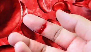 Conoce la enfermedad que sólo afecta a los hombres