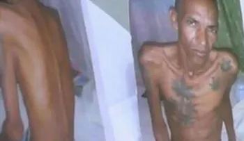 Recluso muere de tuberculosis pulmonar en cárcel de SJM