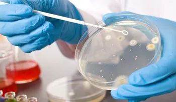 Una proteína de la leche materna podría matar a las bacterias