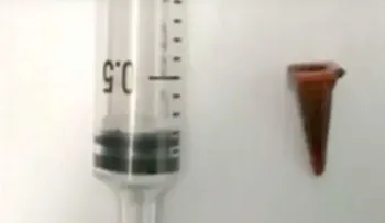 Un caso insólito: un hombre tenía hace 40 años, un cono plástico en su pulmón