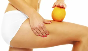 Formas de prevenir y reducir la celulitis y la piel de naranja y volver a cuidados del cuerpo