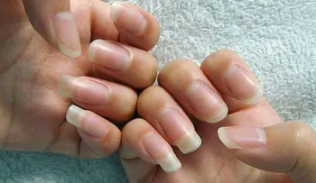 Si una de tus uñas tiene una media luna, tiene que verlo rápido, porque se trata de algo importante