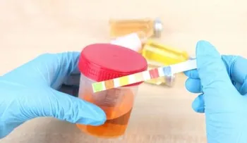 Dicen diagnóstico del zika es más efectivo en análisis de orina