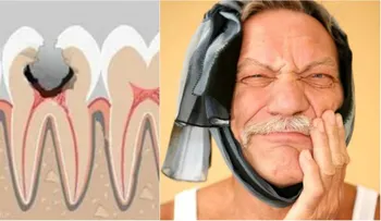 Probé de todo para el dolor de muela, y nada ha ayudadoâ?¦ ¡Por fin, apliqué este remedio!