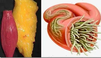 Con estos 2 ingredientes vacié todos los depósitos de grasa y parásitos de mi cuerpo como si nada