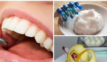 6 trucos caseros para remover el sarro acumulado en los dientes