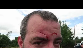 El tiro por la culata: Así le quedó la cara a este hombre tras realizar un disparo fallido