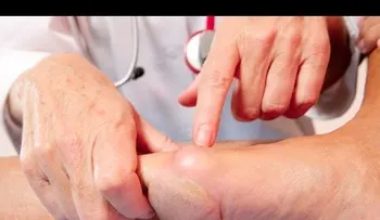 Cómo eliminar el ácido úrico de tu cuerpo de manera muy rápida; remedios 