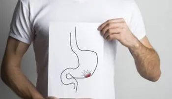 Tumores benignos de cáncer de estómago