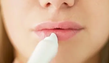 7 tips para evitar que se te partan los labios
