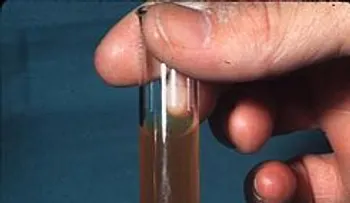Remedio natural para la hematuria (sangre en la orina)