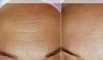 ¿Conoces la Crema 4? Esta crema limpia, aclara, suaviza y quita las arrugas ¡4 Ingredientes, 4 Beneficios!
