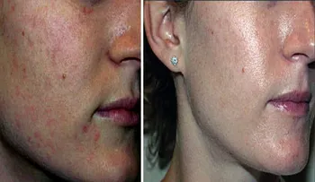 6 buenas razones para utilizar bicarbonato de sodio para la piel y el cabello!