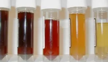 Qué significa el Color de mi Orina ? Conoce la respuesta