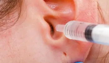 Cómo eliminar el exceso de cera de los oídos de forma natural