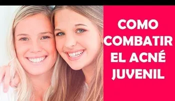 Consejos para eliminar el acne en la Adolecencia