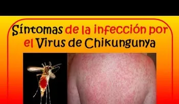El mosquito hembra transmite la chikunguña; efectos enfermedad pueden durar hasta dos años