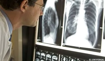 Enfermedad respiratoria cuarta causa de muerte en niños en el mundo