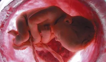 Un estudio confirma los beneficios de retrasar pinzamiento del cordón umbilical