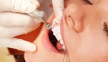 Las caries se producen por consumo de bebidas azucaradas, medicamentos y falta de educación