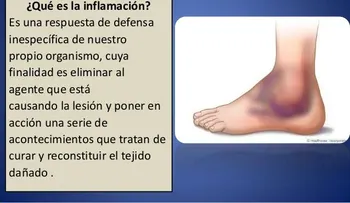 El ibuporeno y el paracetamol alivian el dolor y la inflamación, pero las altas dosis pueden causar problemas a la salud