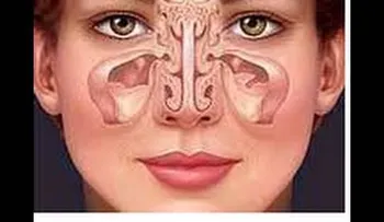 Masaje facial para la sinusitis. Facial massage for sinusitis. ECODAISY
