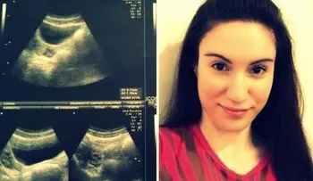 Una chica nace sin vagina y sin útero cuenta su historia