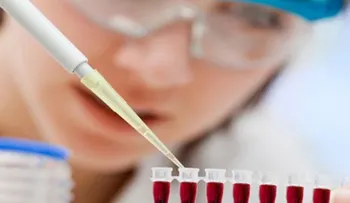 Prueba de ADN de la sangre es más eficaz para detectar síndrome de Down
