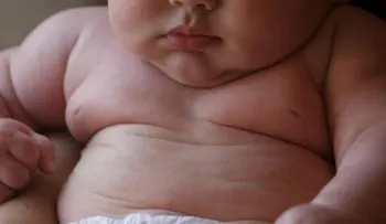 ¡Alerta! 41 millones de niños menores de cinco años son obesos
