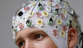 Un medicamento contra el cáncer podría curar la enfermedad de Alzheimer