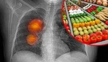 RECETA para limpiar tus pulmones en sólo 3 días! 