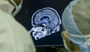 Un chip implantado en el cerebro podría ayudar a aliviar el dolor crónico