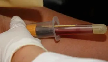  Al menos 15 muertos por un brote de hepatitis E en Namibia 