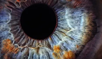 El asombroso síndrome del Ojo Fantasma