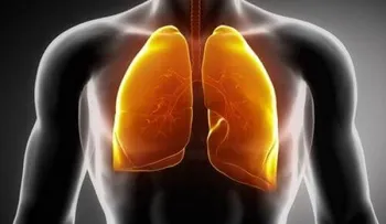 Síntomas del cáncer de pulmón que debes conocer