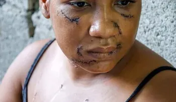 Nayely, madre de tres niñas, sobrevive a 26 estocadas en La Vega y su agresor es enviado a prisión preventiva