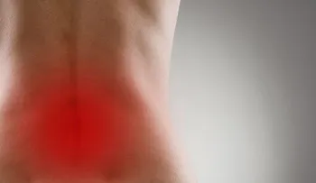 Cómo aliviar el dolor en la espalda baja o lumbar