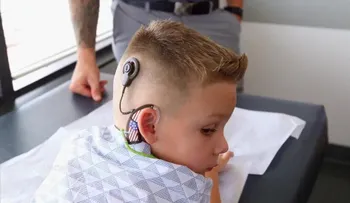 Un oído biónico permite que un niño sordo escuche por primera vez