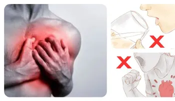 Cómo sobrevivir a un ataque al corazón