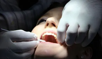  Esclerosis múltiple, la importancia de preservar la salud bucodental 